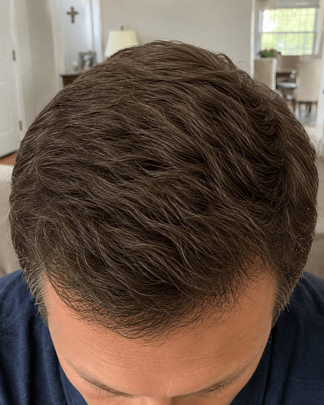 Customer crown photo before and after eight weeks of the Saebom ritual bar